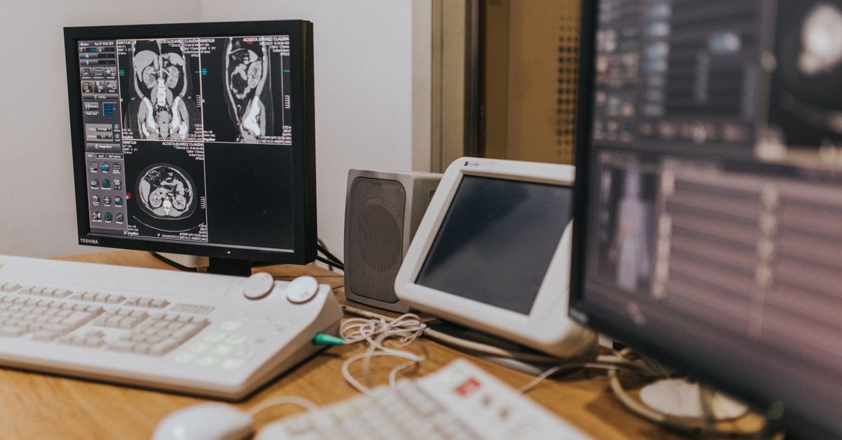Medical imaging setup with MRI scans on multiple screens in a healthcare facility.